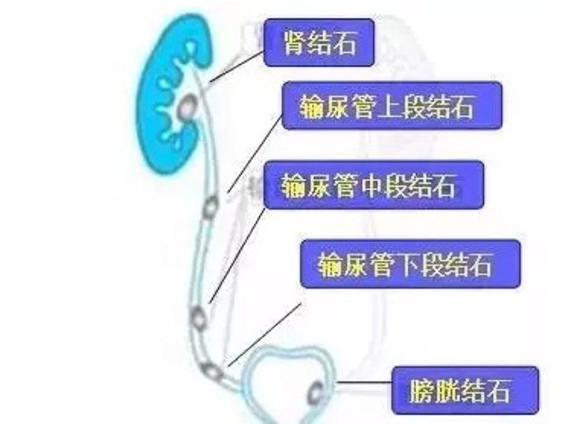 重庆结石病医院：选择最放心的就医之地