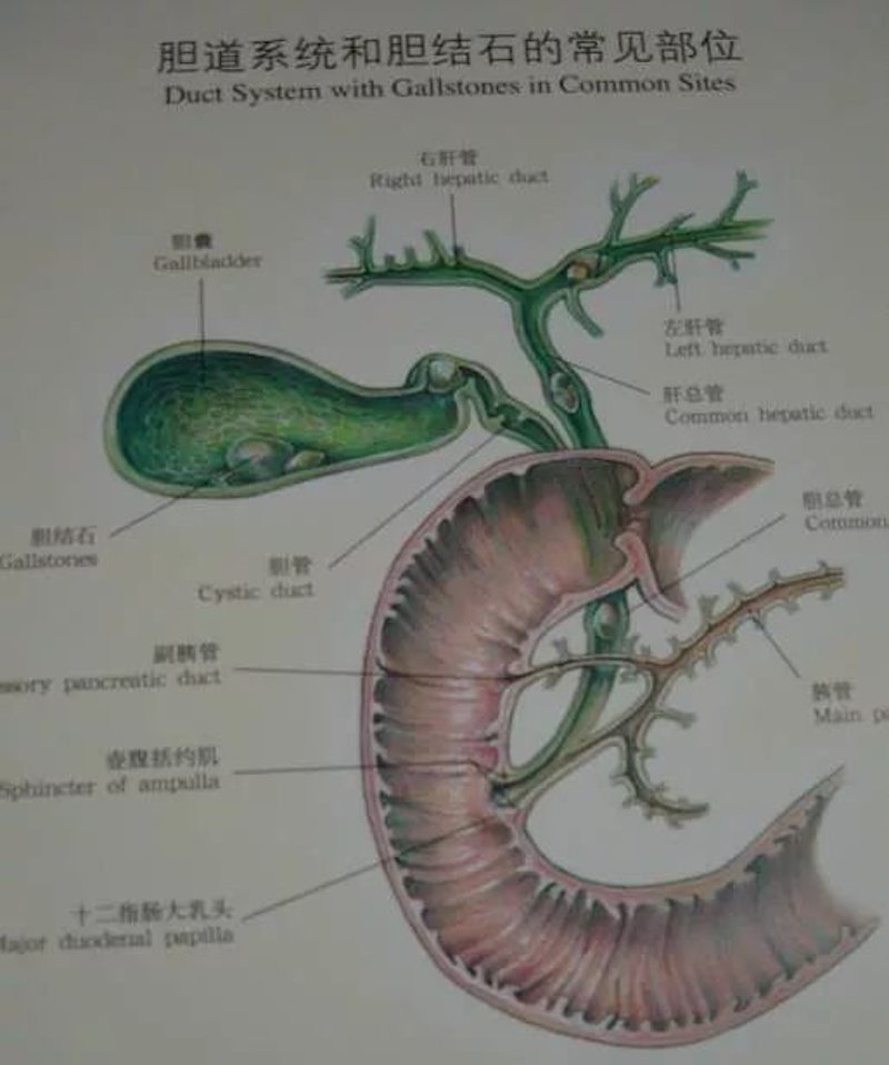 肾结石治疗:未来趋势解读
