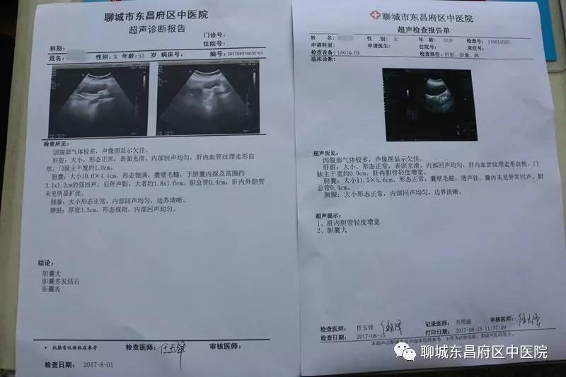 胆结石手术:了解最新疗法与术前术后注意事项