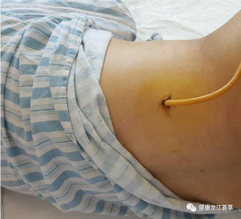 重庆结石病医院：选择最放心的就医之地