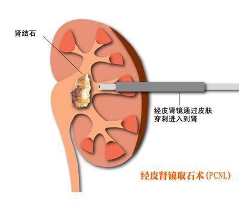 重庆结石病医院最新行业动态分析